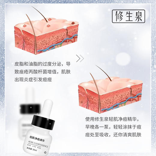 修生泉轻肌净痘精华 商品图4