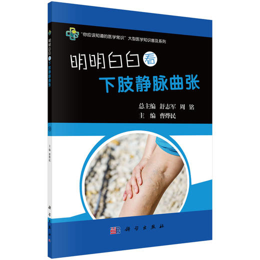 明明白白看下肢静脉曲张/曹烨民 商品图0