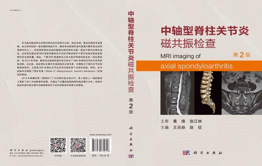 [按需印刷]中轴型脊柱关节炎磁共振检查（第2版）/王炎焱，赵征 商品图3