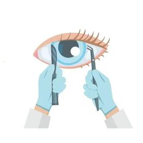 近视手术的谣言是什么？