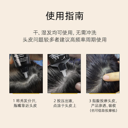【璐璐护发秘籍】温莎森林FORVIL 针对头皮痘痘 干痒 净澈头皮舒缓精华75ml 明星同款 商品图4
