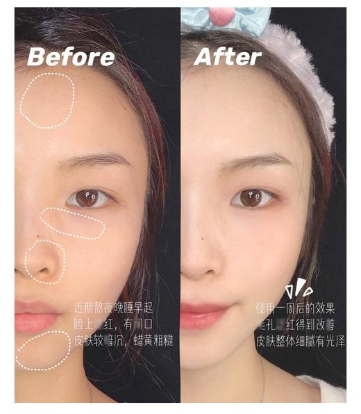 【清仓好价】韩国Dralthea艾医生紫苏蚕丝面膜28g*5片/3盒 商品图3