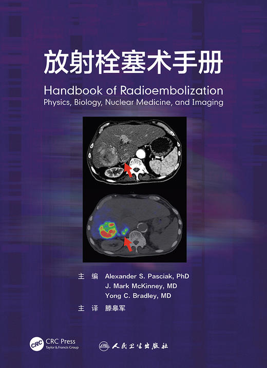 放射栓塞术手册 2022年10月参考书 9787117328791 商品图1