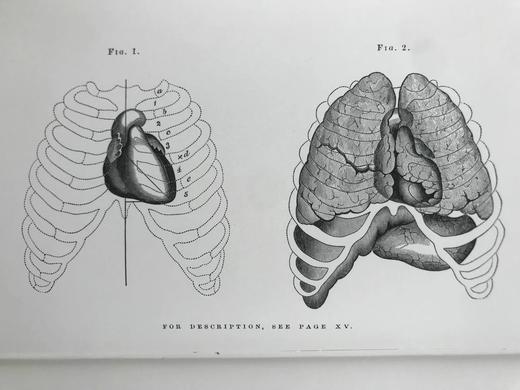 医学经典奥斯汀·费林特《心脏病的诊断、病理与治疗实践》 2幅插图 豪华皮装18开 商品图5