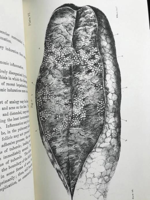 医学经典托马斯·艾迪生作品集 约8页插图 豪华皮装大32开 商品图6