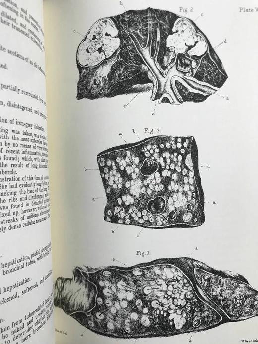 医学经典托马斯·艾迪生作品集 约8页插图 豪华皮装大32开 商品图7