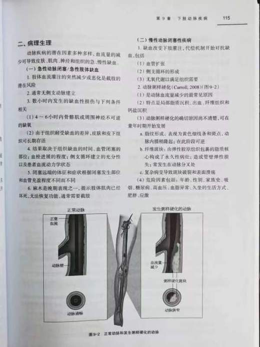 血管护理核心教程 商品图5