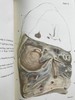 医学经典托马斯·艾迪生作品集 约8页插图 豪华皮装大32开 商品缩略图11