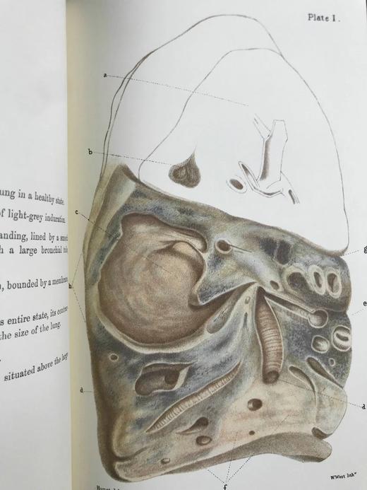 医学经典托马斯·艾迪生作品集 约8页插图 豪华皮装大32开 商品图11