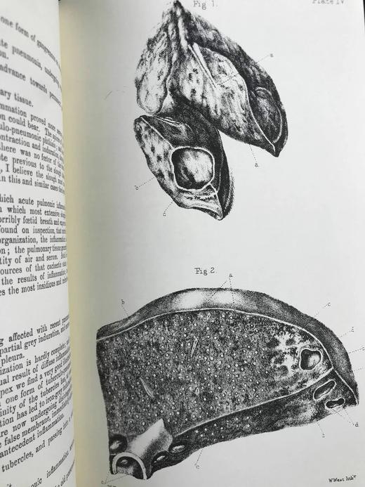 医学经典托马斯·艾迪生作品集 约8页插图 豪华皮装大32开 商品图8