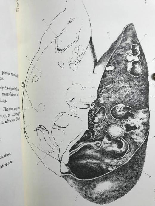 医学经典托马斯·艾迪生作品集 约8页插图 豪华皮装大32开 商品图5