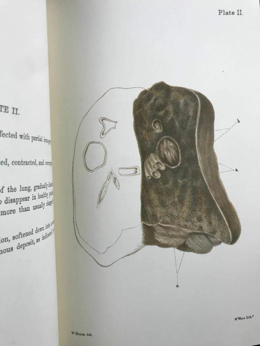 医学经典托马斯·艾迪生作品集 约8页插图 豪华皮装大32开 商品图10