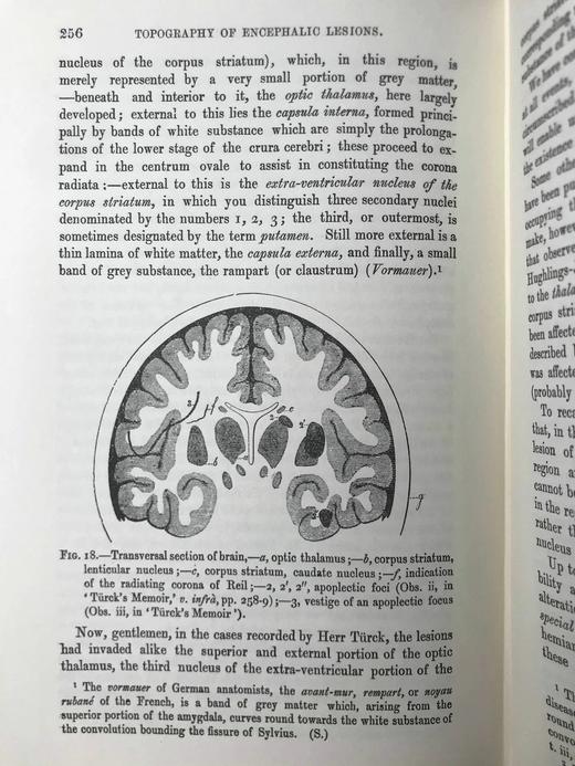 医学经典让-马丁·沙可《神经系统疾病讲座》（全3卷） 约百幅插图 豪华皮装大32开 商品图12
