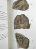 医学经典托马斯·艾迪生作品集 约8页插图 豪华皮装大32开 商品缩略图9