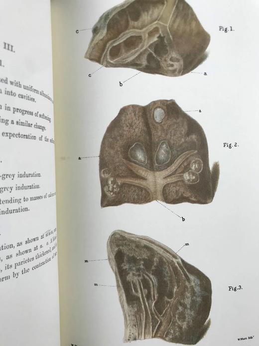 医学经典托马斯·艾迪生作品集 约8页插图 豪华皮装大32开 商品图9