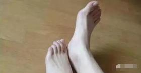 伸伸脚，就知肾脏好不好 