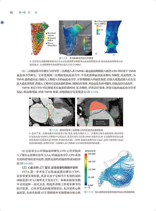 现货 心血管病CT诊断学 第3版 戴汝平 支爱华主编 心血管CT诊断基础 冠状循环及其相关疾病CT诊断 人民卫生出版社9787117329538 商品图4