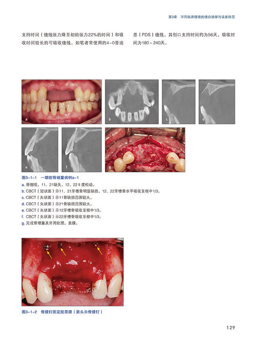 精准缝合 种植及相关术式中的应用 满毅主编 种植牙口腔外科学缝合术 手术操作应用方法缝合细节 辽宁科学技术出版社9787559126115 商品图4