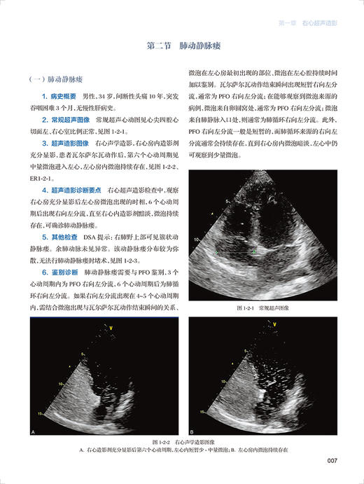 全4册 腹部超声造影图鉴+妇产+心血管+浅表器官超声造影图鉴 超声造影图鉴丛书套装 诊断学医学磁共振CT影像学书籍人民卫生出版社 商品图4