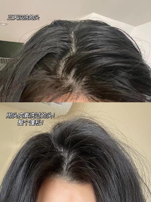 【7天发货】第四代科丽尼青蒿头皮素75ml 商品图4