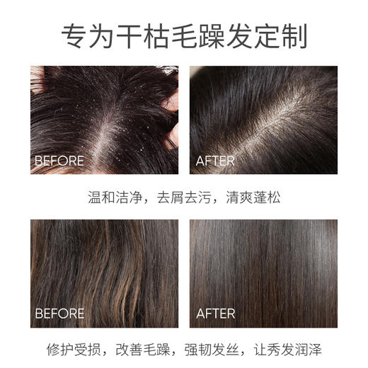 欧贝斯去屑洗发露（滋养柔顺型）750ml 商品图2