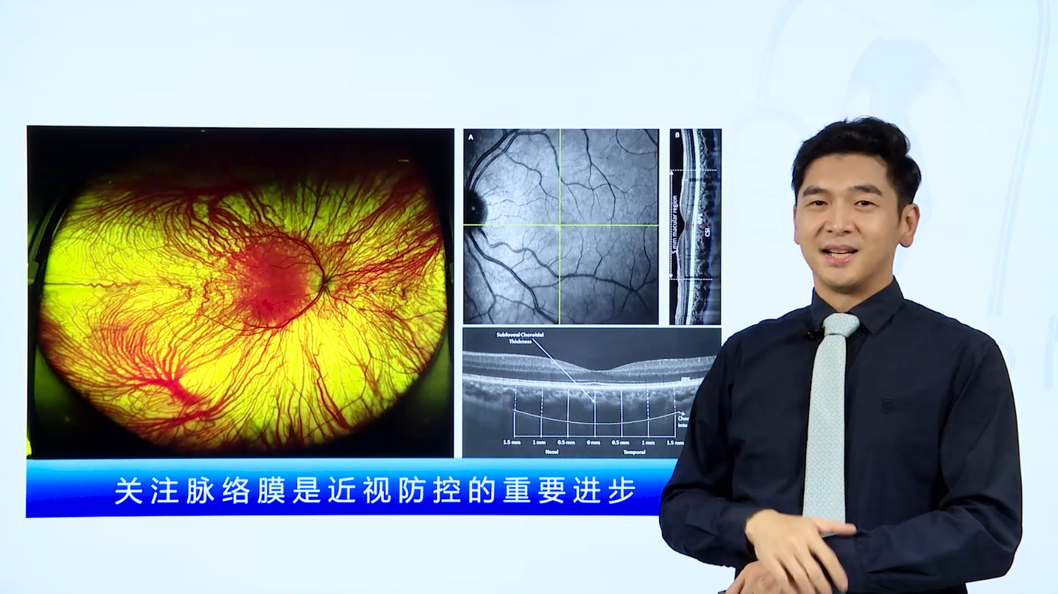 第一讲: 1.2视光知识