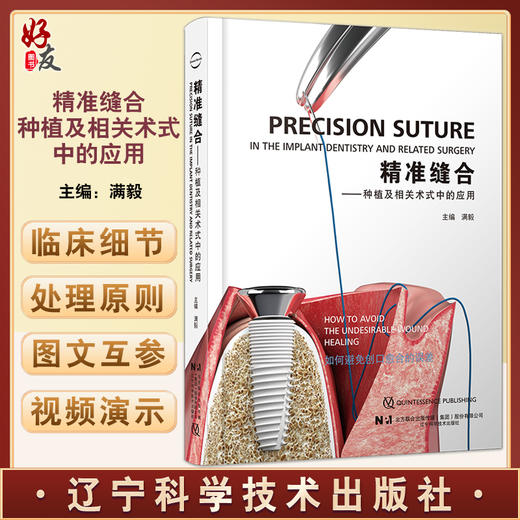 精准缝合 种植及相关术式中的应用 满毅主编 种植牙口腔外科学缝合术 手术操作应用方法缝合细节 辽宁科学技术出版社9787559126115 商品图0