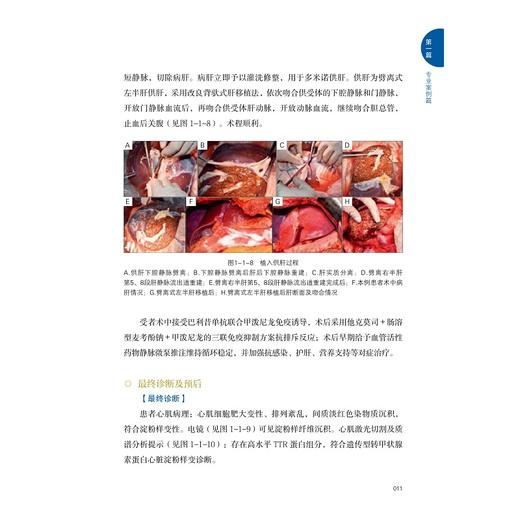 浙一路·凝心聚力——多学科诊疗病例精选/国家医学中心创建经验丛书/浙江大学医学院附属第一医院建院75周年/梁廷波/浙江大学出版社 商品图1