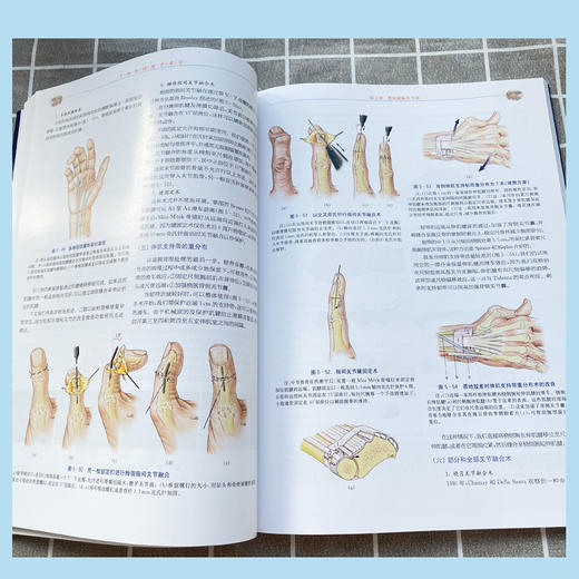 手外科择期手术学 商品图4