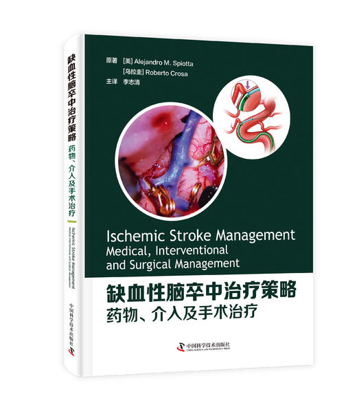 缺血性脑卒中治liao策略：药wu、介入及手术治liao 商品图0