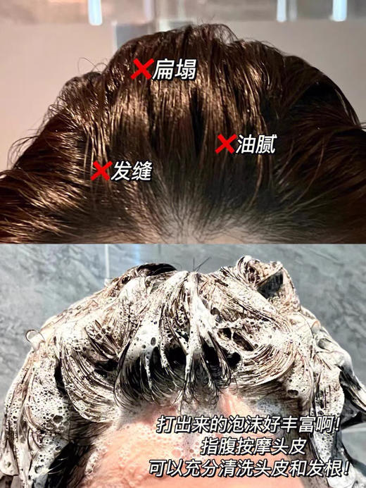 强韧发根！日本资生堂护理道头皮生机洗发水/护发素1000ml 商品图13