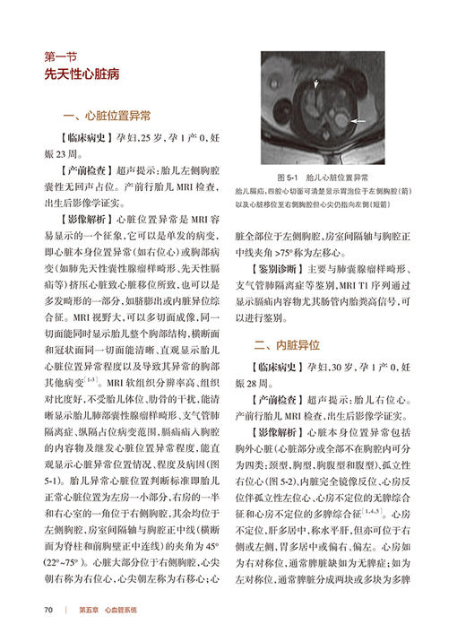 现货 产前影像诊断病例集 兰为顺 杨文忠主编 胎儿各系统先天畸形磁共振 典型图像诊断要点鉴别诊断 人民卫生出版社9787117333689 商品图4