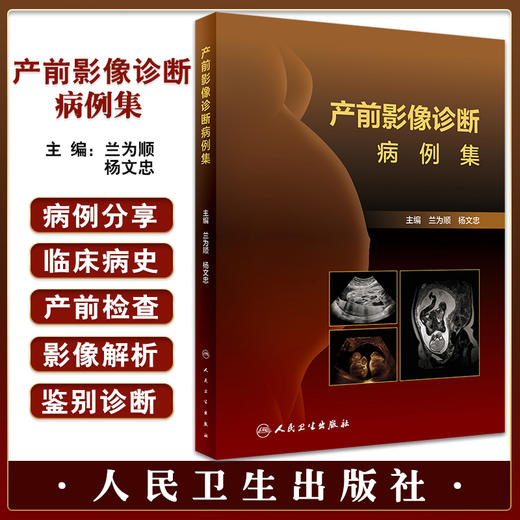 现货 产前影像诊断病例集 兰为顺 杨文忠主编 胎儿各系统先天畸形磁共振 典型图像诊断要点鉴别诊断 人民卫生出版社9787117333689 商品图0
