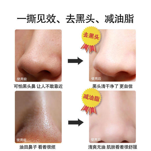 抖音去黑头鼻贴粉刺鼻子鼻头贴吸黑头收缩毛孔学生螨虫黑头贴 商品图3