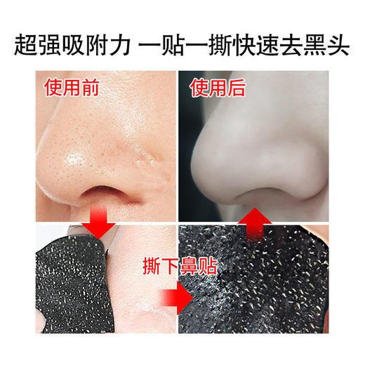 抖音去黑头鼻贴粉刺鼻子鼻头贴吸黑头收缩毛孔学生螨虫黑头贴 商品图1