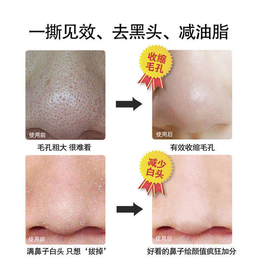 抖音去黑头鼻贴粉刺鼻子鼻头贴吸黑头收缩毛孔学生螨虫黑头贴 商品图4