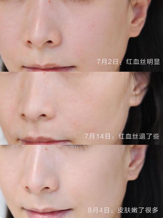 【限时折扣】Snowberry雪果蓝铜胜肽新光焕颜亮彩精华液30ml 商品图2