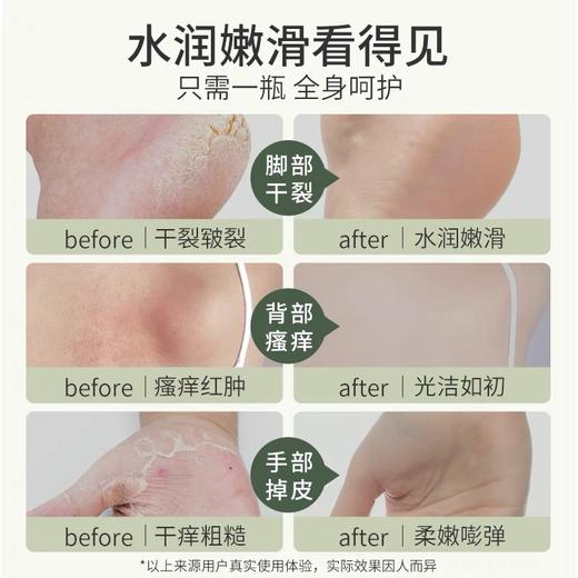 后辰鸸鹋油（皮肤急救百宝瓶） 商品图4