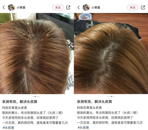 【7天发货】第四代科丽尼青蒿头皮素75ml 商品图3