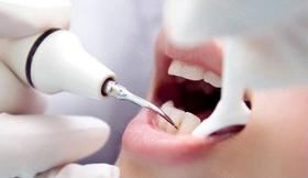 明星同款烤瓷牙，一时光鲜好看，对牙齿的危害却是不可逆的！