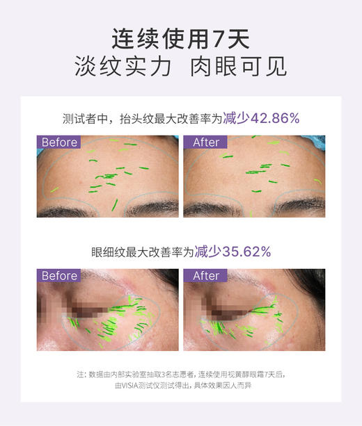 【低价清仓  买一送一】【全脸淡纹 全脸可用】敬修堂佰花方视黄醇眼霜紧致肌肤淡化眼纹细纹黑眼圈抗皱淡纹20g/支 【质保期26年5月21日】 商品图1