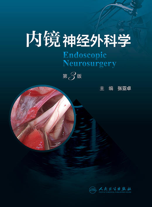 内镜神经外科学（第3版） 2022年11月参考书 9787117338547 商品图1