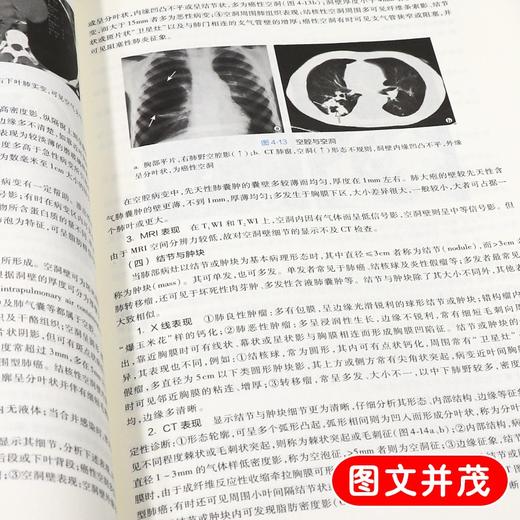 全2册 医学影像学第8版+医学影像学学习指导与习题集第3版 基础临床预防口腔十三五规划 供基础 临床等专业用 人民卫生出版社 商品图4