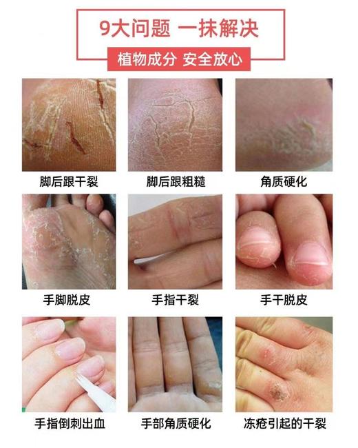 【新品】秀丽足蜗牛防开裂护脚霜100g 商品图2