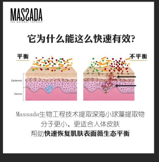 Massada玛莎达益生元修复精华油改善敏感肌美容护肤精油30ml 商品图2