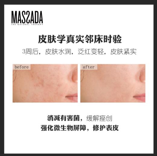 Massada玛莎达益生元修复精华油改善敏感肌美容护肤精油30ml 商品图4