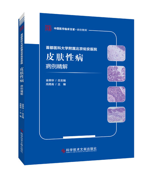 首都医科大学附属北京佑安医院皮肤性病病例精解 高艳青主编 商品图0