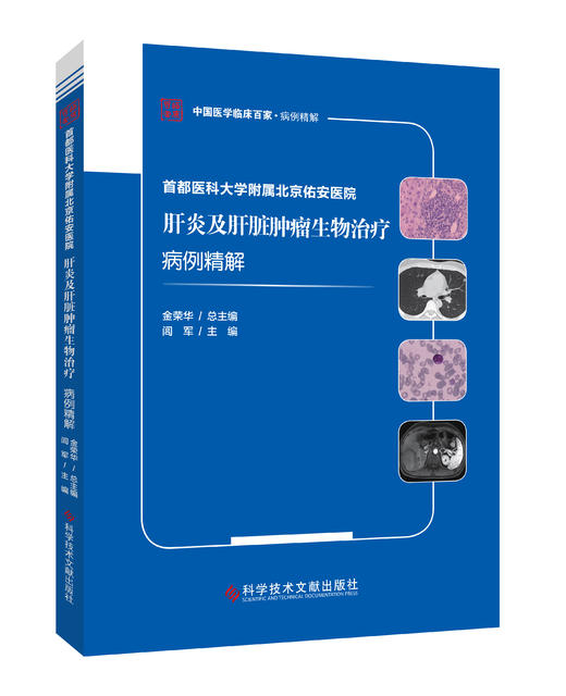 正版现货 首都医科大学附属北京佑安医院肝炎及肝脏肿瘤生物治疗病例精解 闾军主编 商品图0