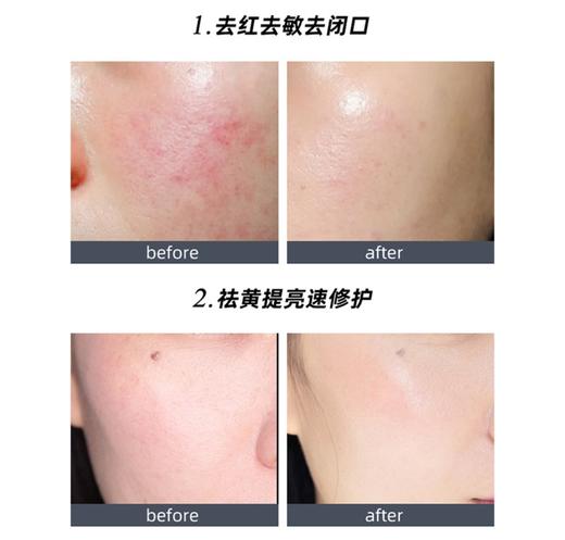 德美乐嘉多维面膜75ml 商品图4