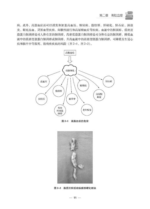 心血管疾病护理科普案例解析 王静 梁爱琼 李海燕 心脏血管疾病护理病案 科学技术文献出版社9787518993864 商品图3